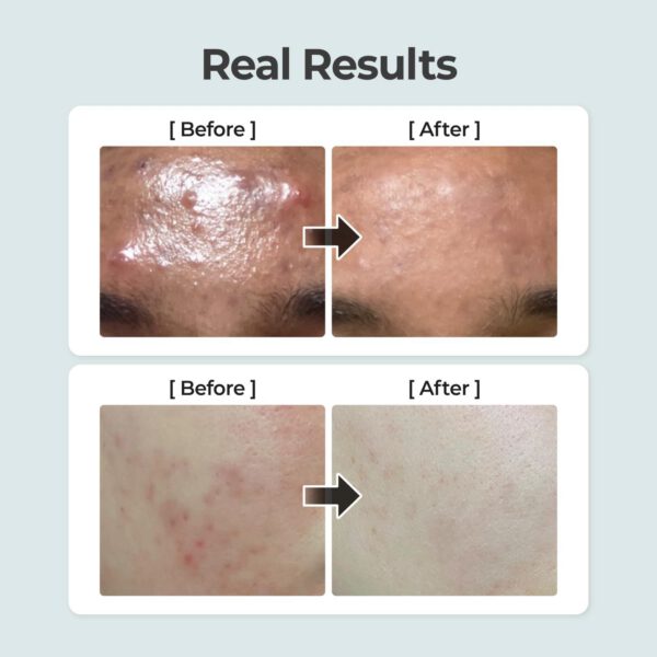 NUMBUZIN Nº1 - Calming Herb Toner 300 ml - Tonico Calmante - Imagen 4