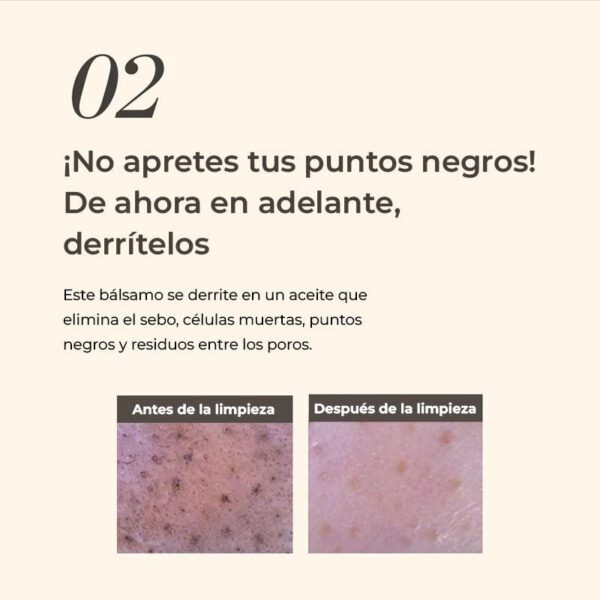 HEIMISH All Clean Balm Mandarin - Bálsamo Desmaquillante MINI TALLA 5ml - Imagen 5