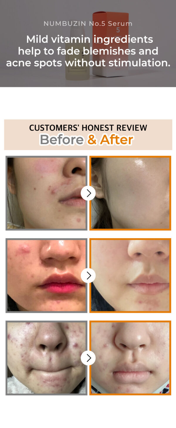 NUMBUZIN #5 - Goodbye Blemish Serum 50 ml - Serum Antirojeces Calmante - Imagen 5