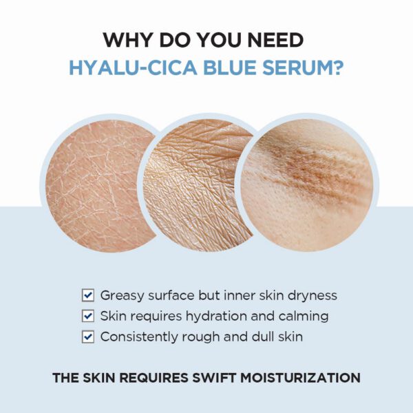 SKIN1004 Centella Hyalu-Cica Blue Serum 30 Ml - Mini Talla - Imagen 3
