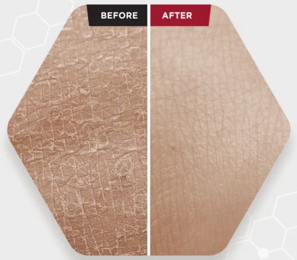 SKIN1004 Bloody Peel Zombie Beauty - Peeling 17 % Acido Glicolico - 30 ml - Imagen 5