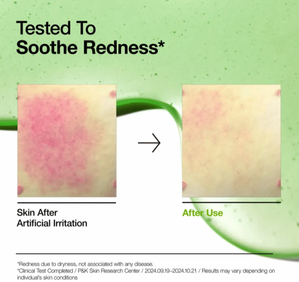 ANUA Azelaic Acid 10% Serum - Serum Anti-rojeces  30 ml - Imagen 3