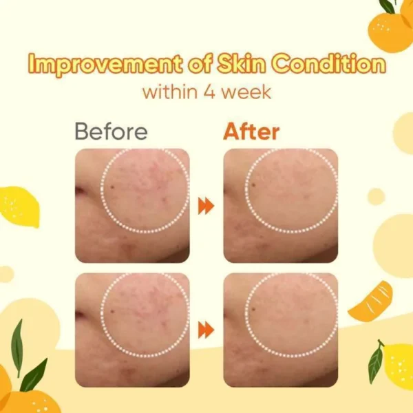 SKIN004 - COMMONLABS Vitamin C - Crema Gel  - 50 ML - Imagen 2