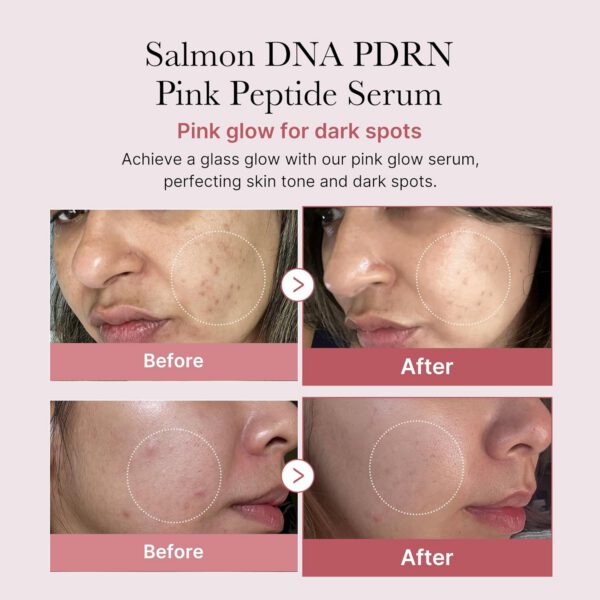 MEDICUBE PDRN Pink Peptide Serum - Serum Antiedad 30 ml - Imagen 4