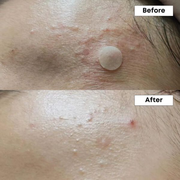 NINELESS - A Control 10% Azelaic acid Serum -30 ml - Imagen 3