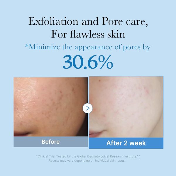 MEDICUBE Zero Pore Toner - Tónico exfoliante 250 ml - Imagen 2