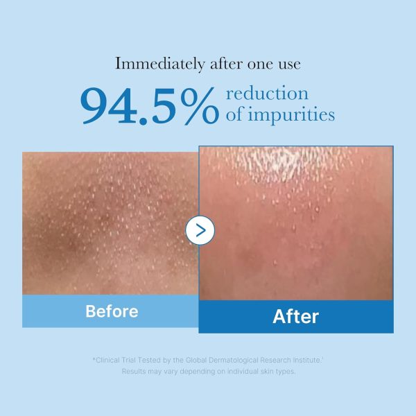 MEDICUBE Zero Pore Blackhead Deep Cleansing Oil - Aceite de Limpieza 205 ml - Imagen 2