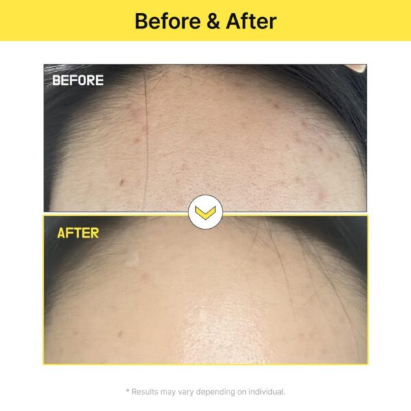TIAM Alpha-5 Mela Cream - Crema Despigmentante 50 ml - Imagen 6