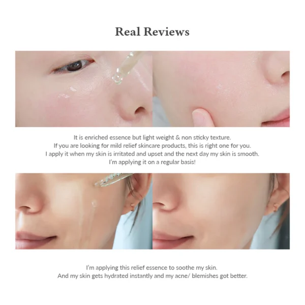 DR. ALTHEA Skin Relief Essence - 30ml - Imagen 5