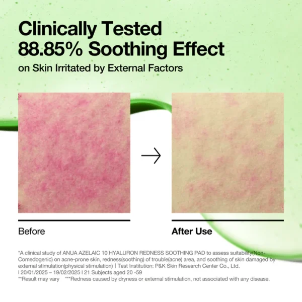 ANUA Azelaic Acid Toner Pads 90 pzs - Imagen 6
