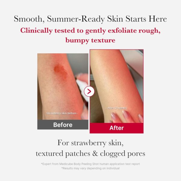 MEDICUBE Red Body  Shot - Serum Corporal Antiacné 110g - Imagen 9