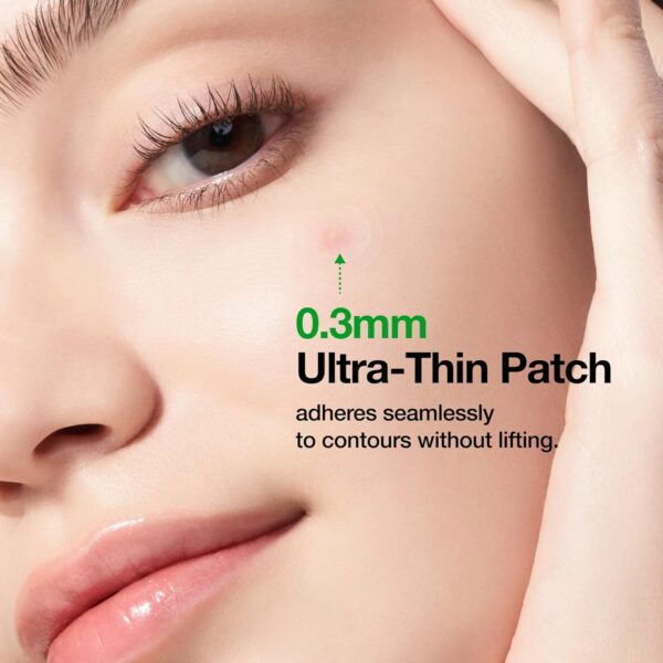 ANUA Microdart Patch 12 pzs - Parche Antiacné - Imagen 6