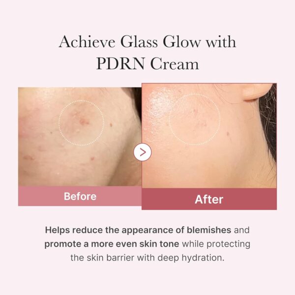 MEDICUBE PDRN Pink Hyaluronic Moisturizing Cream - 50ml - Imagen 4