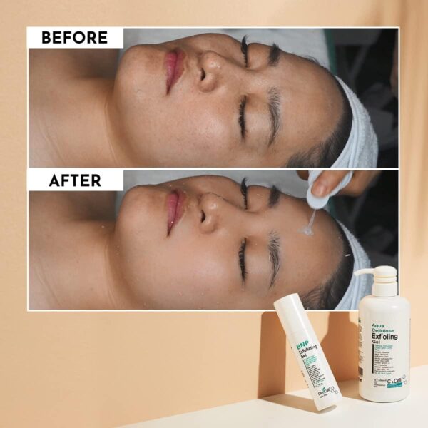 DM.CELL - BNP Exfoliating Gel  - Exfoliante Gomage - 500ml - Imagen 3