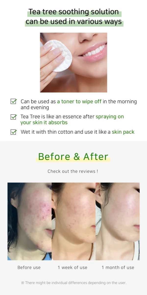 DM.CELL - Tea Tree Soothing Solution - Tónico Anti-inflamatorio AntiAcne 100ml - Imagen 5