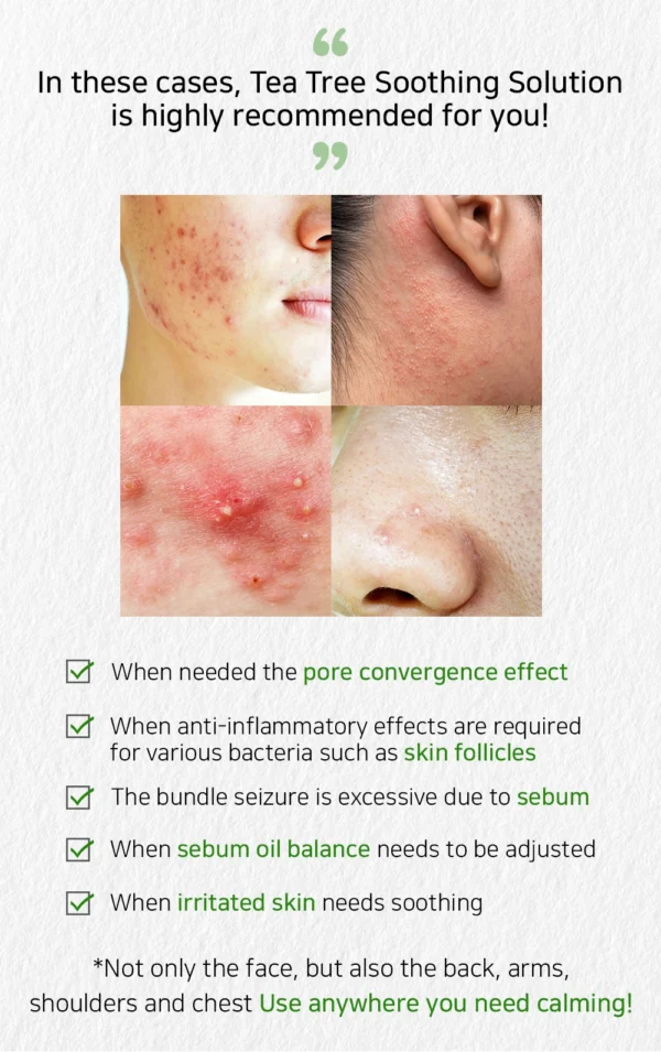 DM.CELL - Tea Tree Soothing Solution - Tónico Anti-inflamatorio AntiAcne 100ml - Imagen 4